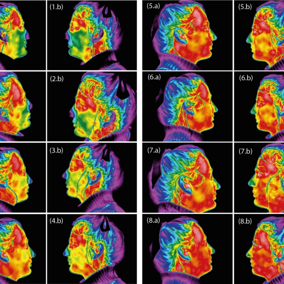 Crainal Dental Thermography Product Image