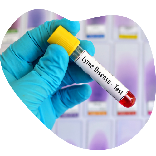 Lyme Disease Test vial Blob Image